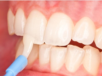 WHY IS FLOURIDE GOOD FOR OUR TEETH ?